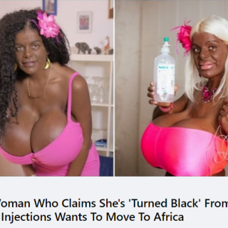 transraciald744d4cf2f5c38d4