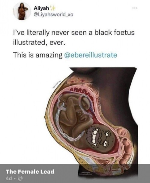 black-fetus-illustrated-tyrone-nigger-47098d010038fe0782f6021564011cac.jpeg