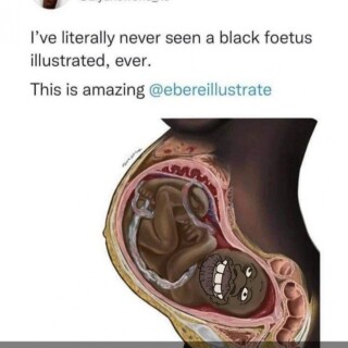 black-fetus-illustrated-tyrone-nigger-47098d010038fe0782f6021564011cac